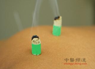 點擊將在新窗口查看全圖 中醫(yī)艾灸養(yǎng)生的十大禁忌