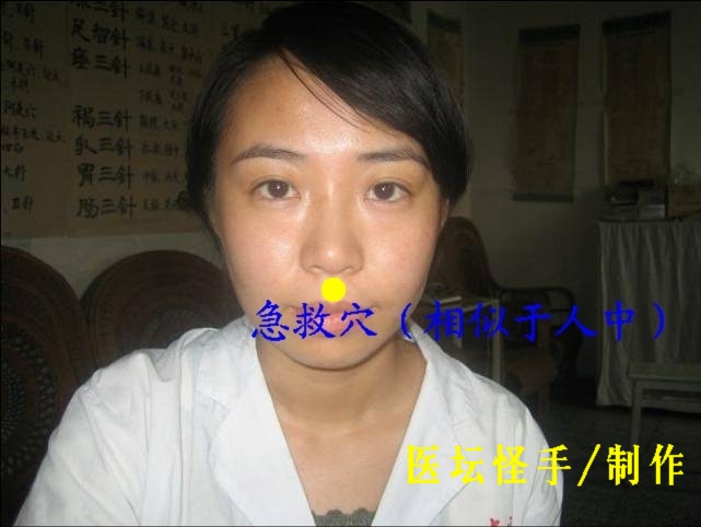 點擊將在新窗口查看全圖 王文遠平衡針灸穴位圖 - 3396815 - 3396815博愛