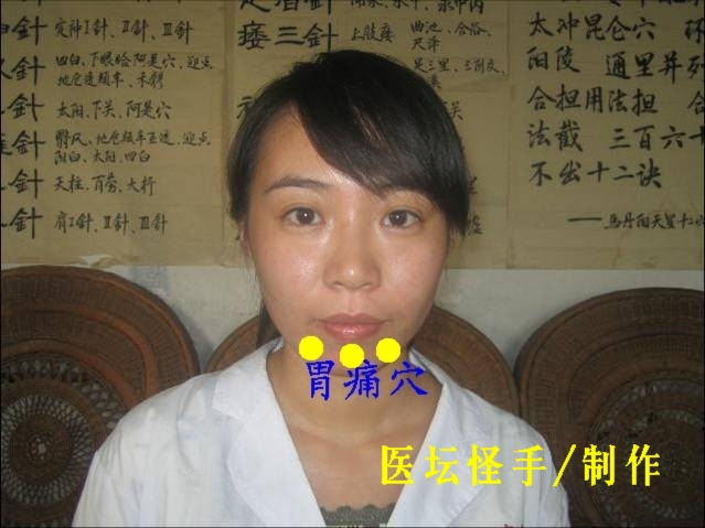 點擊將在新窗口查看全圖 王文遠平衡針灸穴位圖 - 3396815 - 3396815博愛