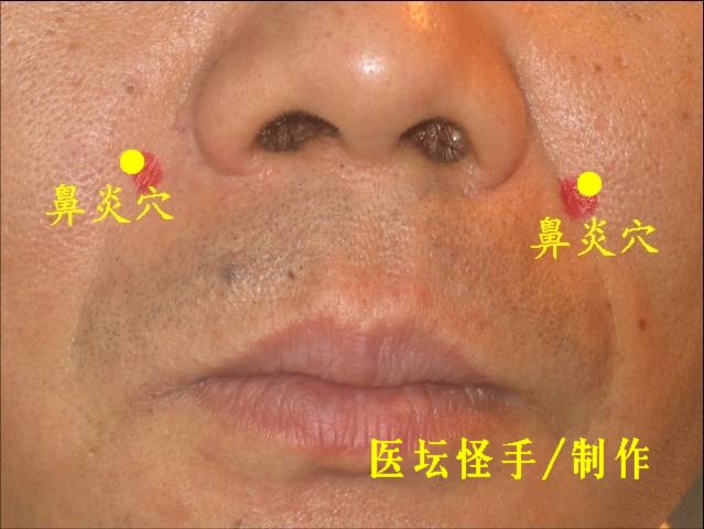 點擊將在新窗口查看全圖 王文遠平衡針灸穴位圖 - 3396815 - 3396815博愛