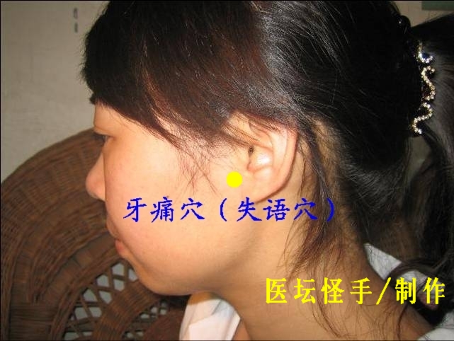 點擊將在新窗口查看全圖 王文遠平衡針灸穴位圖 - 3396815 - 3396815博愛