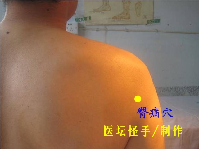 點擊將在新窗口查看全圖 王文遠平衡針灸穴位圖 - 3396815 - 3396815博愛