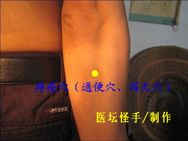 點擊將在新窗口查看全圖 王文遠平衡針灸穴位圖 - 3396815 - 3396815博愛