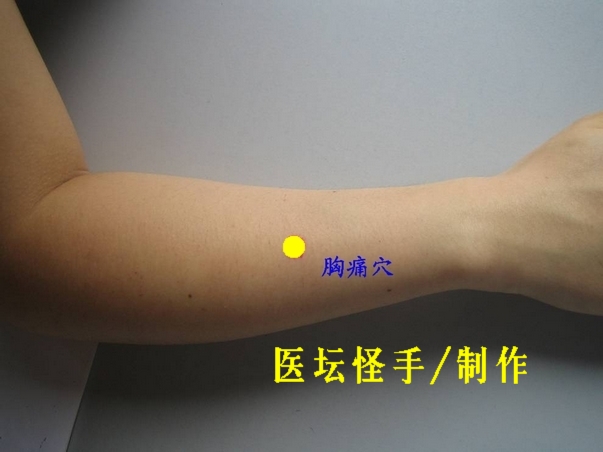 點擊將在新窗口查看全圖 王文遠平衡針灸穴位圖 - 3396815 - 3396815博愛