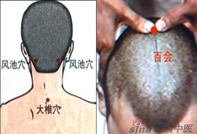 常見病艾灸時怎樣選穴？--大椎百會穴